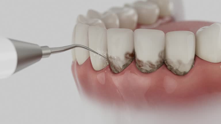Trusted Emergency Dentist service in Ozark, AR - Dentist Open Now